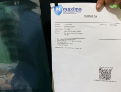 Kecelakaan di Laut Soropia, Diduga Ditabrak MT Fathur Rezki, Kondisi Korban Alami Paru-Paru Penuh Cairan